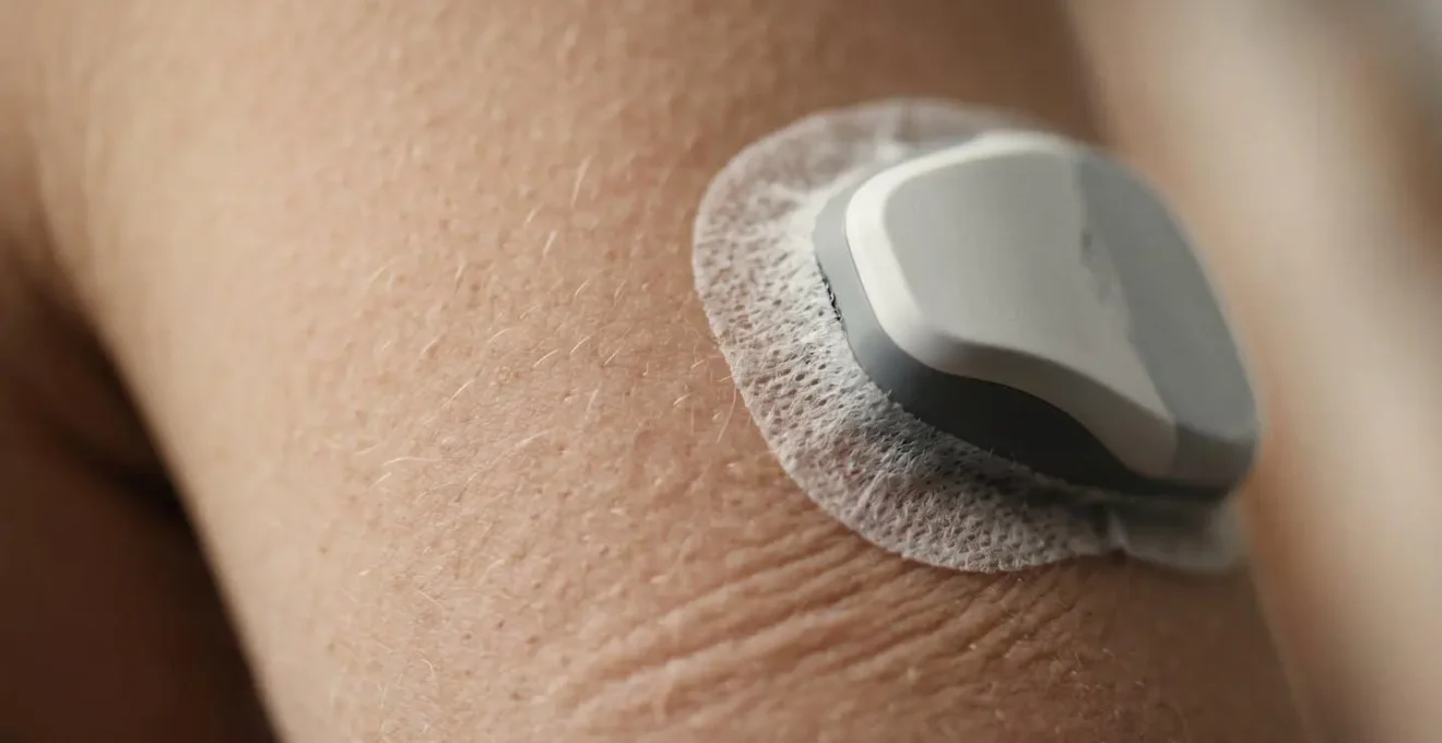 Macro close-up of continuous glucose monitoring sensor with natural skin texture showing personal health tracking